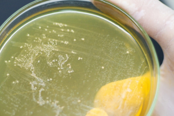 Estudian los beneficios del empleo de bacterias lácticas en alimentos y salud